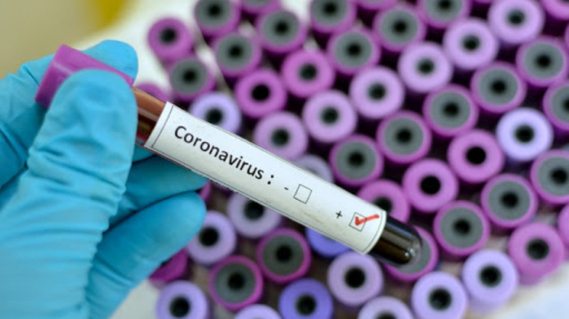 tampone-coronavirus-positivo